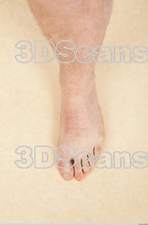 Photo reference of foot 0001